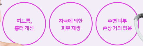 아현역피부과 여드름흉터치료 타임리스 시크릿RF 관련 이미지 4