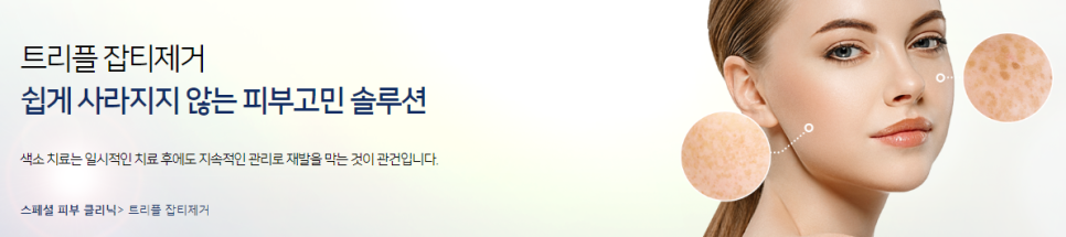 기미주근깨 깨끗한 피부를 원한다면? 관련 이미지 2