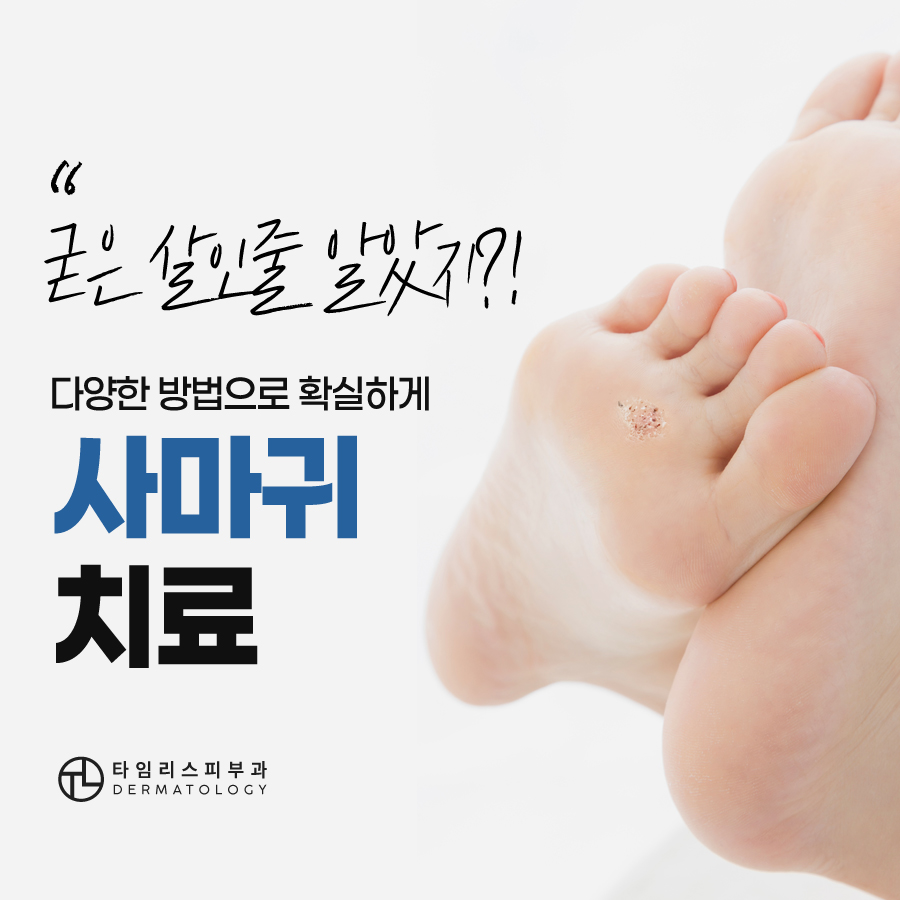 마포사마귀치료 빠르면 빠를수록 관련 이미지 8