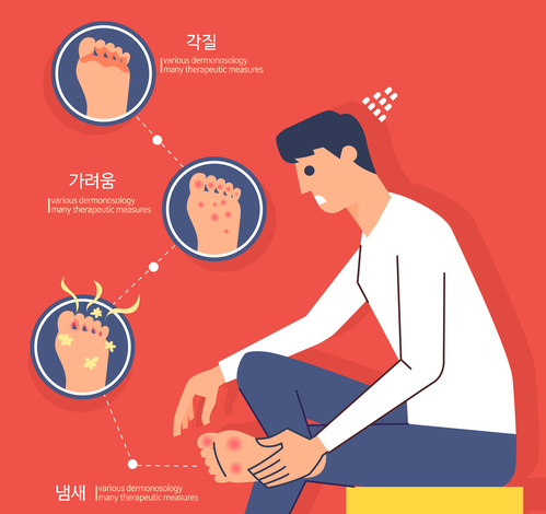 발톱무좀치료 약복용없이 손톱까지 실비보험 가능 관련 이미지 2