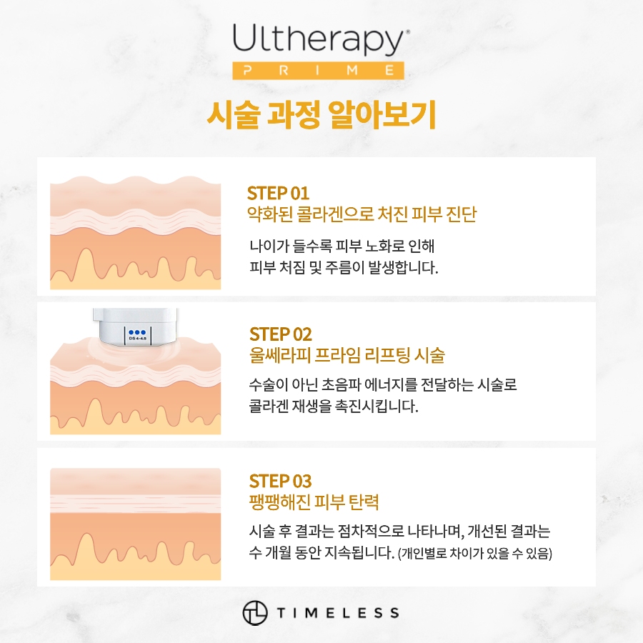서대문구리프팅 울쎄라피프라임으로 탄력있게 관련 이미지 7