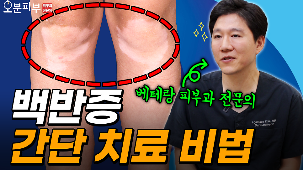 피부 위에 흰 반점이 생겼다면? 관련 이미지 1