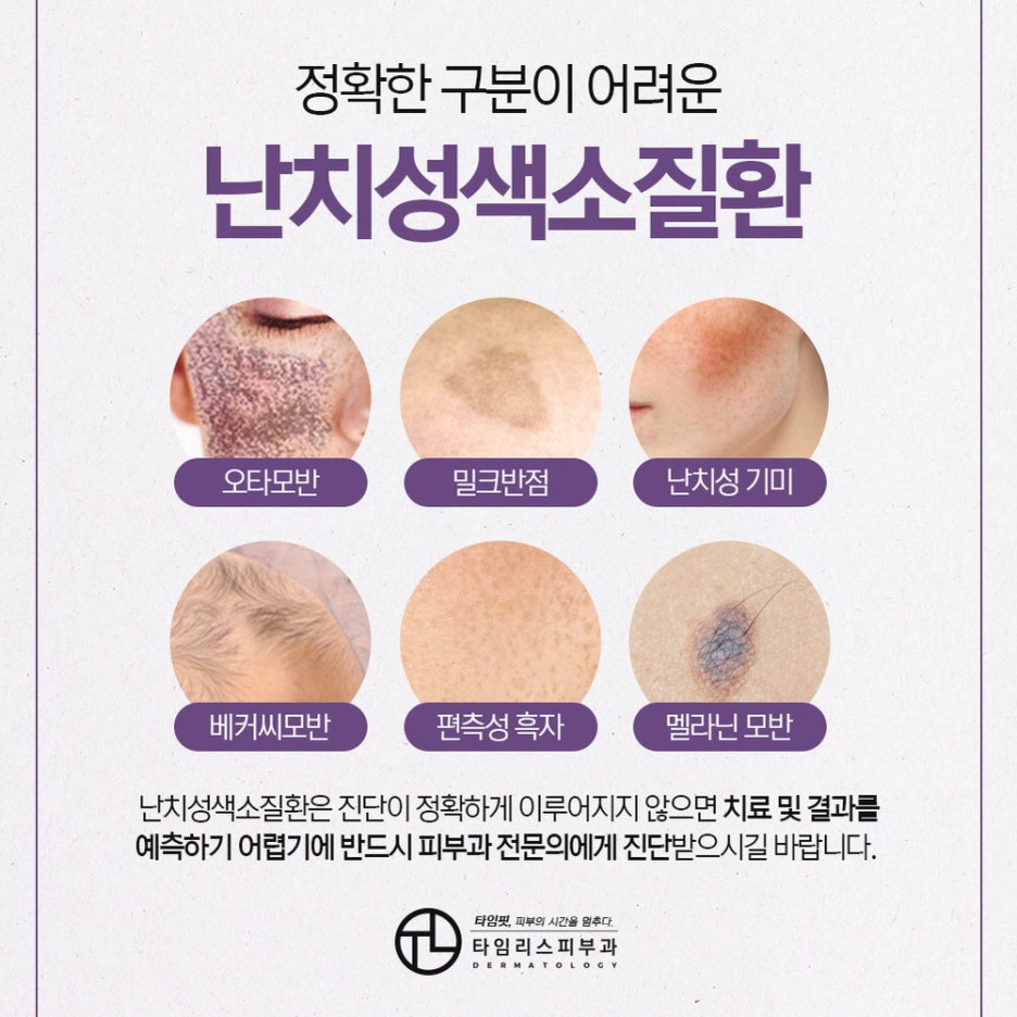 난치성색소질환 투명한 피부로 변화하려면 관련 이미지 2