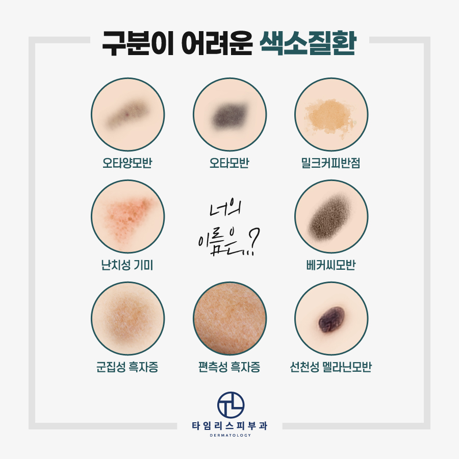 마포피부과전문의 정확한 진단이 관건! 관련 이미지 3