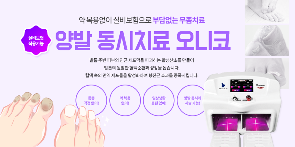 공덕발톱무좀치료 타임리스에서 오니코레이저 실비100% 관련 이미지 4