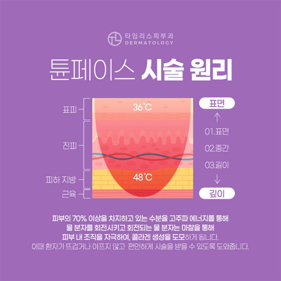 마포튠페이스로 매끄러운 얼굴라인을 관련 이미지 5