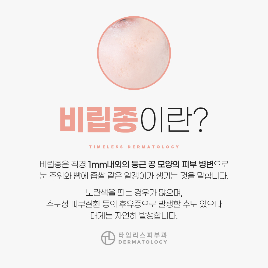 얼굴비립종 오돌토돌 피부에 생겼다면? 관련 이미지 2