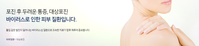 대상포진증상 방치하면 큰일나요 관련 이미지 1