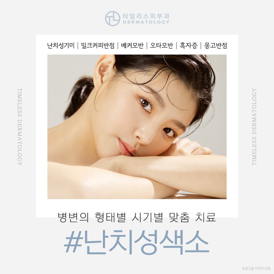 밀크커피반점치료 방치하기보다는 관련 이미지 1