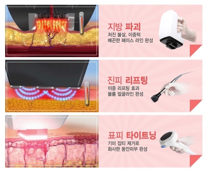 아현역피부과 인모드리프팅 관련 이미지 5