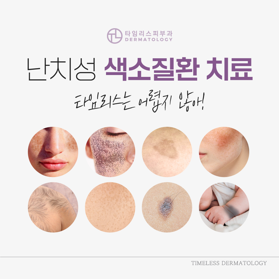 색소치료피부과 진단에 적합한 방법으로 관련 이미지 1