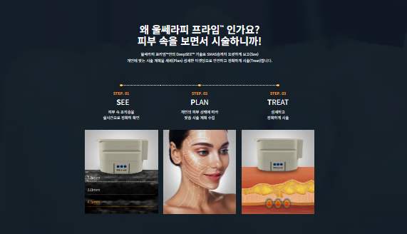 정확도가 다른 리프팅을 찾고 계신다면 마포 울쎄라피 프라임 관련 이미지 6