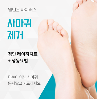 사마귀치료 제거후관리 까지 전염되기전에 관련 이미지 4