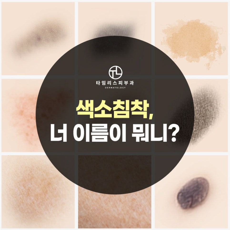 아현역피부과 색소질환 고민, 말끔히 해결! 관련 이미지 2