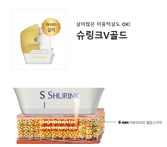 슈링크 효과 잔주름부터 이중턱까지 리프팅으로 탄력개선 관련 이미지 5