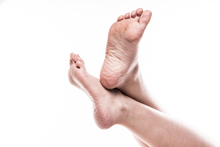사마귀 티눈 차이 구별법 알아두세요 치료는 어떻게 관련 이미지 1