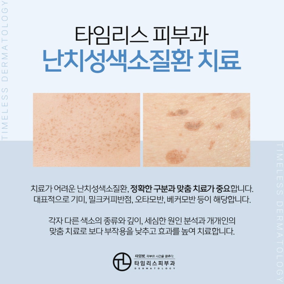 마포피부과전문의 섬세한 진료로 맑고 투명한 피부! 관련 이미지 2