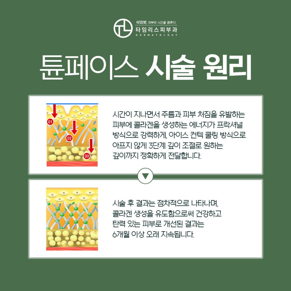 대흥역피부과 환하고 탁 트인 얼굴을 바란다면 관련 이미지 3