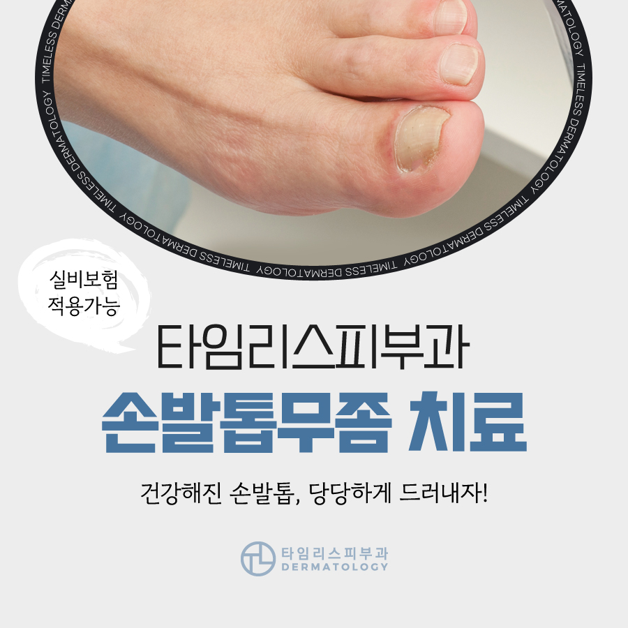 발톱무좀치료방법 당당히 드러내려면 관련 이미지 1