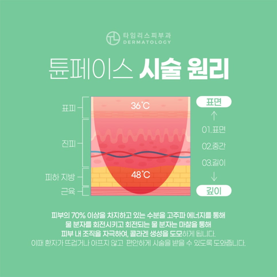 대흥역피부과 튠페이스 통해서 피부 탄력을! 관련 이미지 4
