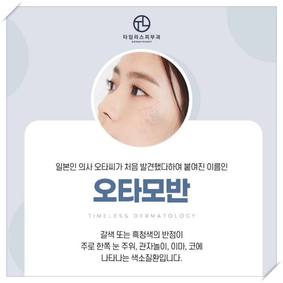아현역피부과 색소질환이 생기는 원인 관련 이미지 3