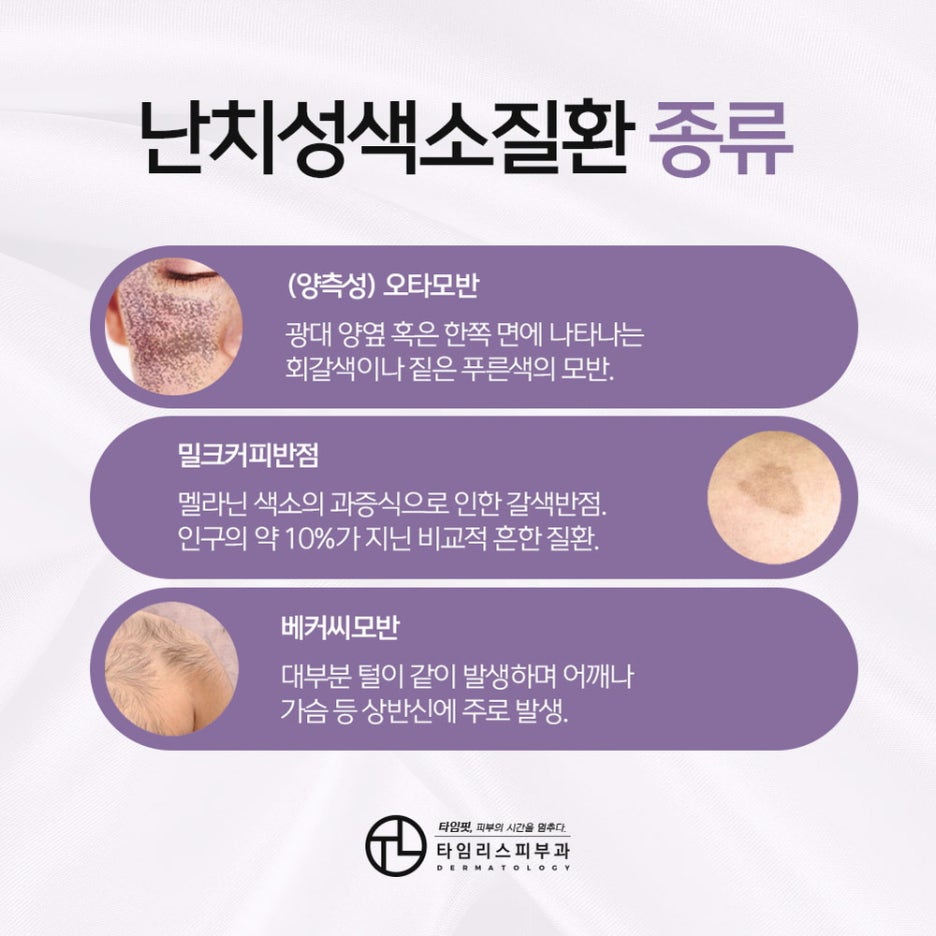 얼굴잡티제거비용, 방법이 궁금하다면? 관련 이미지 3