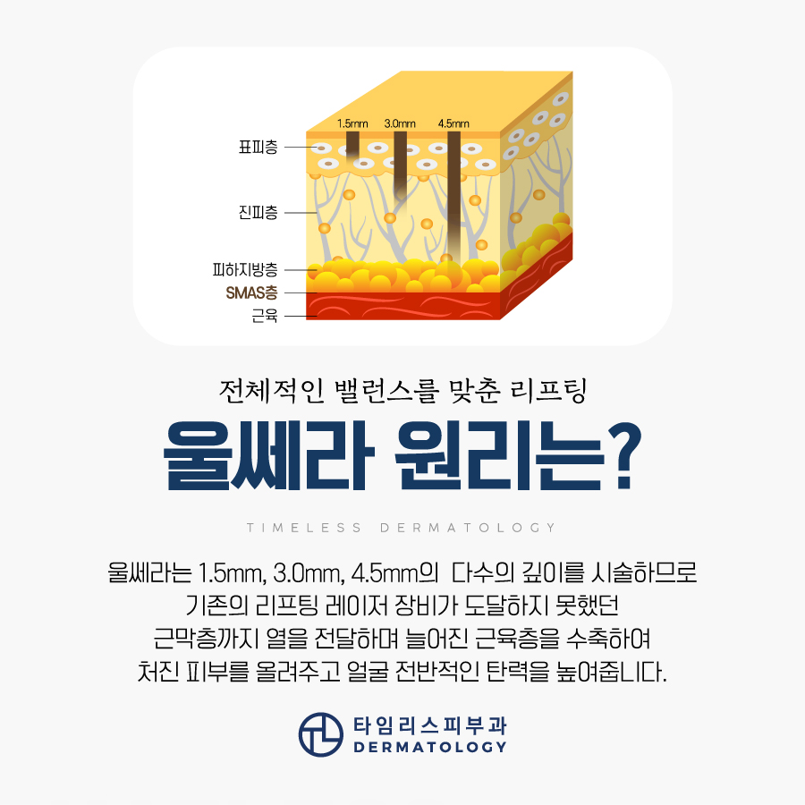 아현리프팅 울쎄라 잘하는곳 찾는다면 관련 이미지 3
