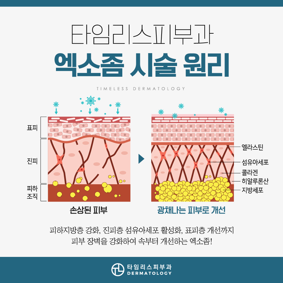 신촌엑소좀 탄력 잃고 넓어진 모공 고민이라면 관련 이미지 5