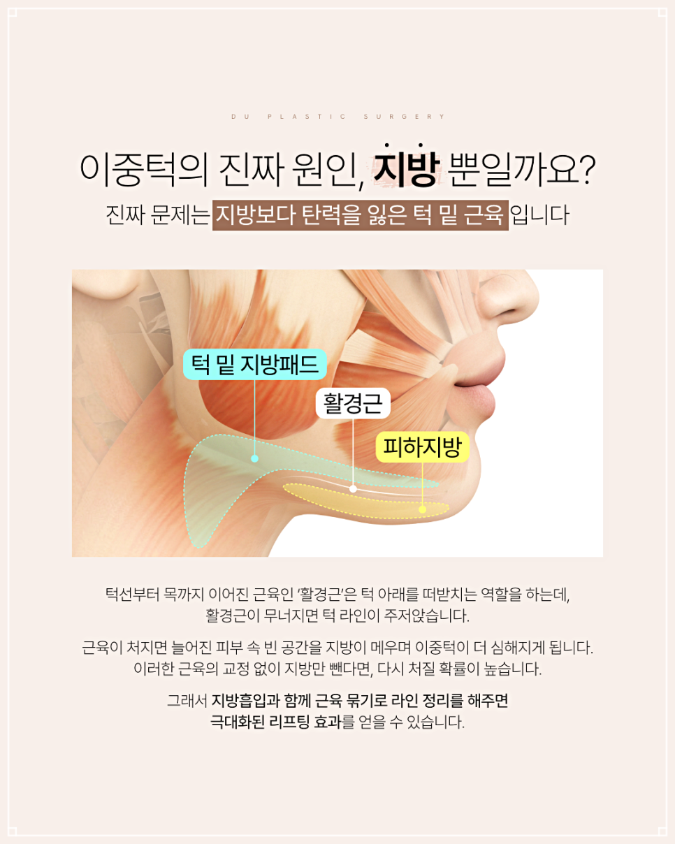 Why Double Chin Botox Is Not a Fundamental Solution image 3