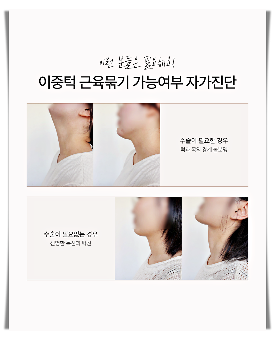 How Can You Get Double Chin Muscle Tightening Safely Without Side Effects? image 10