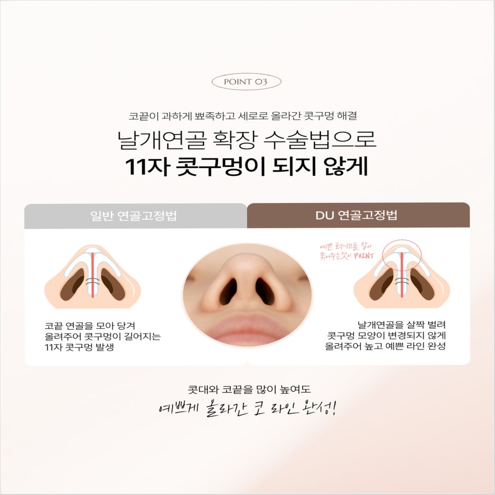 Autologous Cartilage Nose Surgery: The Real Reason Choosing a Plastic Surgery Clinic Determines the Outcome image 7