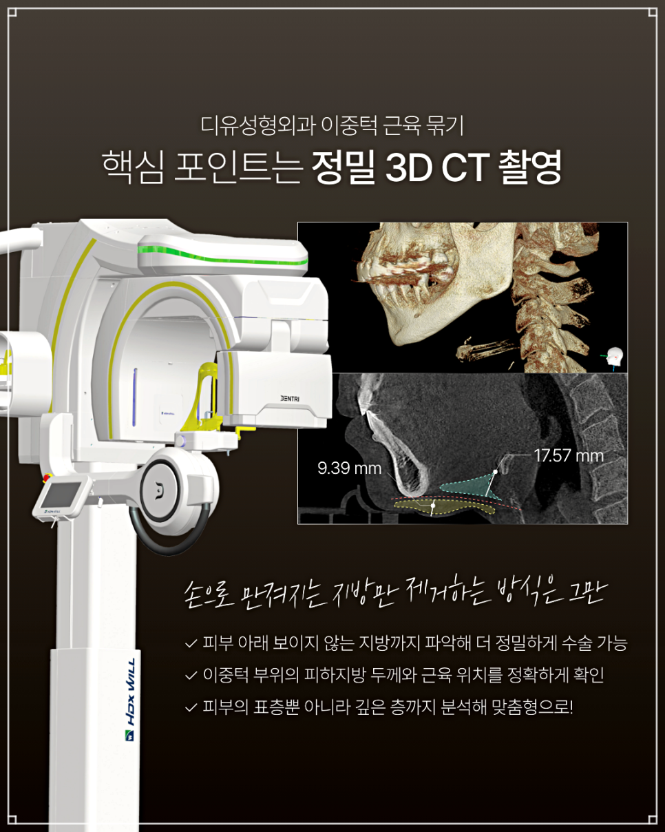 Why Double Chin Botox Is Not a Fundamental Solution image 2