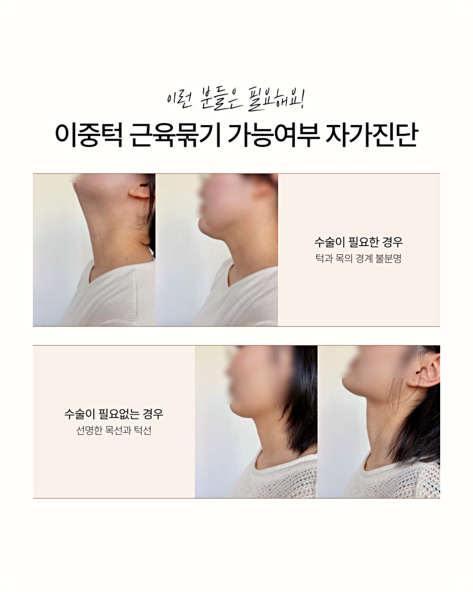 Why Double Chin Botox Is Not a Fundamental Solution image 7