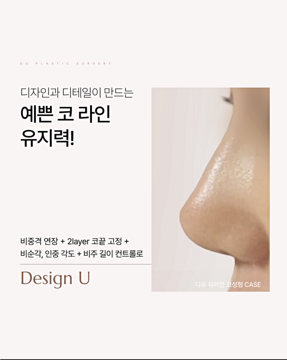 Revision Rhinoplasty Revision Surgery: Why You Should Choose a Plastic Surgery Clinic More Carefully Than for the First Surgery image 5