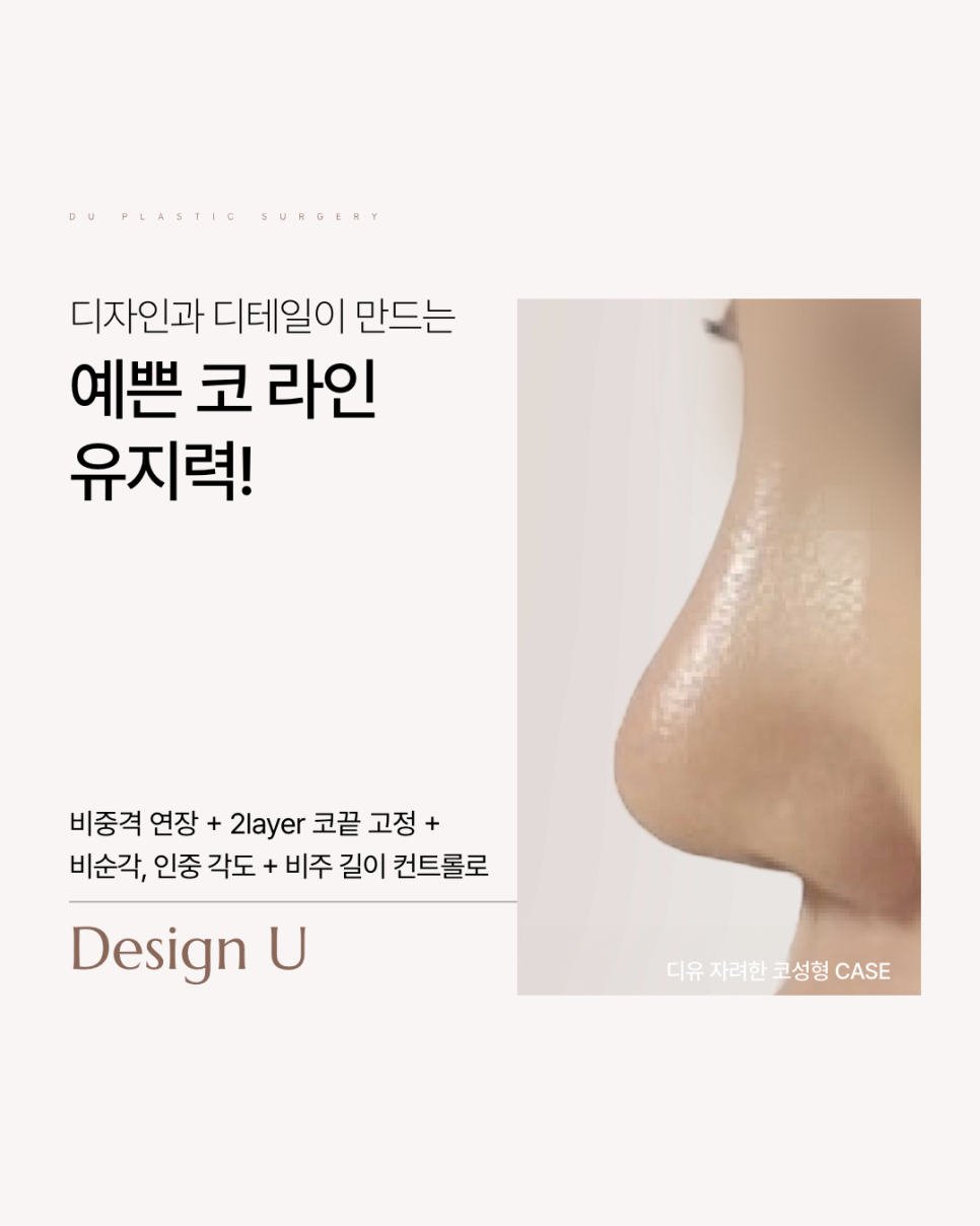코성형재수술, 단순한 미용이 아니라 구조 복원입니다 관련 이미지 6