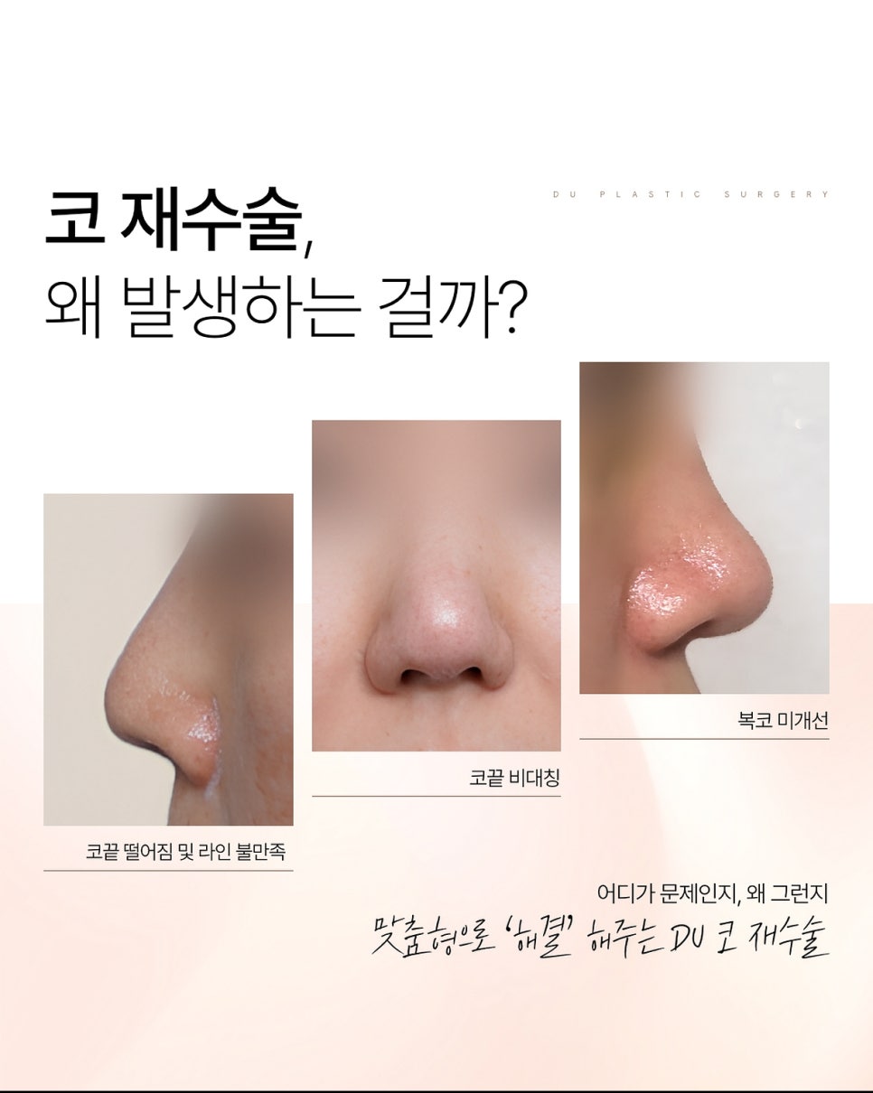 디유성형외과는 당신만의 아름다운 변화를 디자인합니다 관련 이미지 8