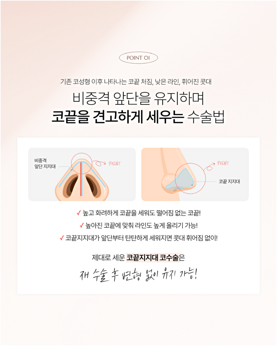 늑연골코수술부작용이 걱정되시는 분들은 읽어보세요 관련 이미지 2