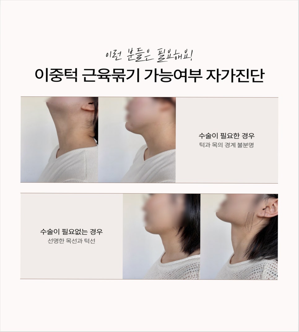 Why Double Chin Surgery Should Be Done at a Trusted Clinic image 4
