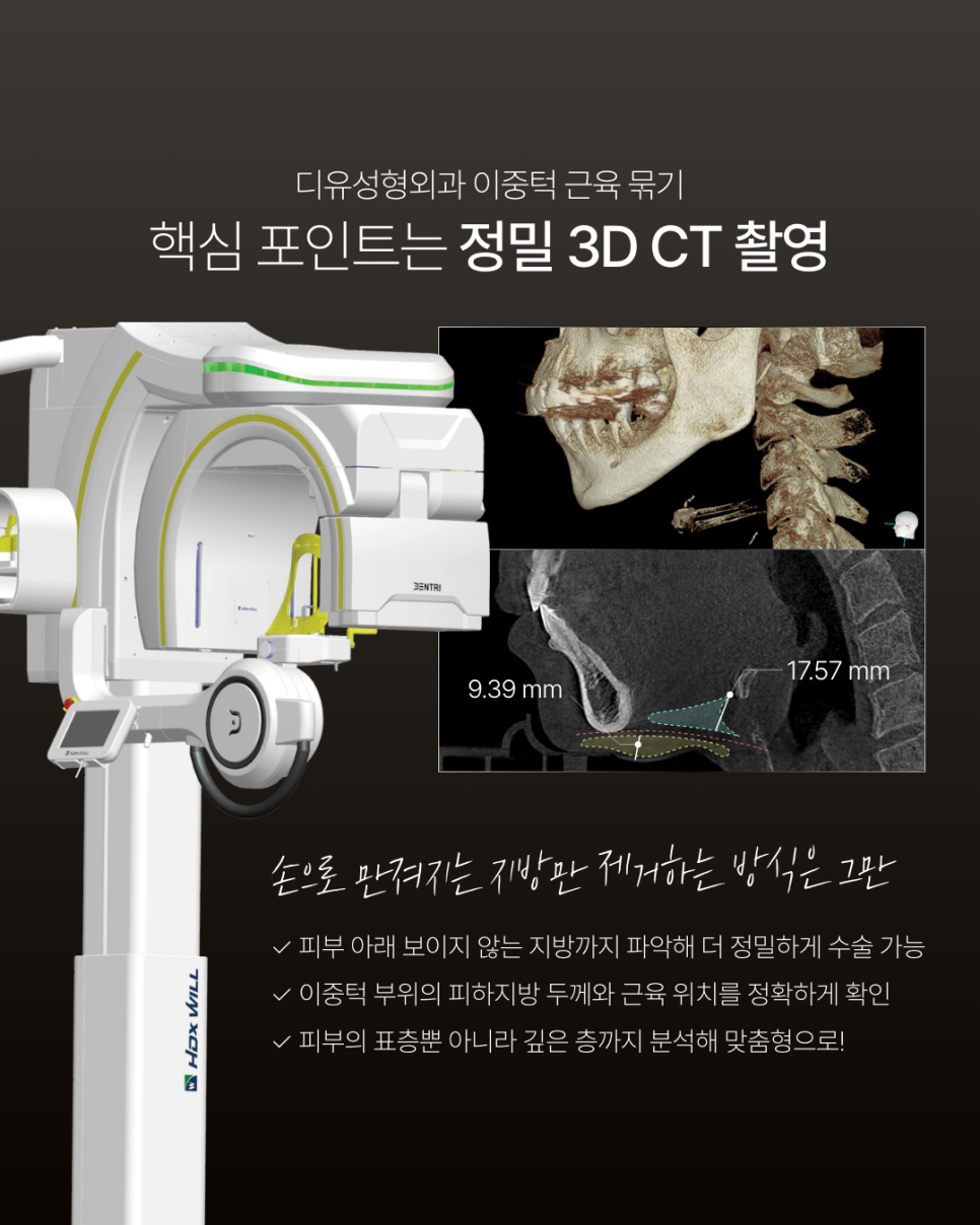 매부리코재수술 더 신중하게 결정해야 하는 이유 관련 이미지 6