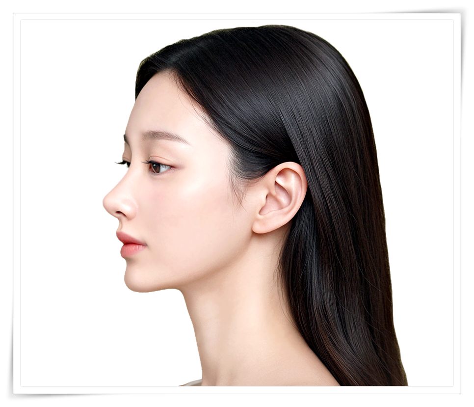 A Design Method to Avoid Failure in Short Nose Revision Surgery image 14