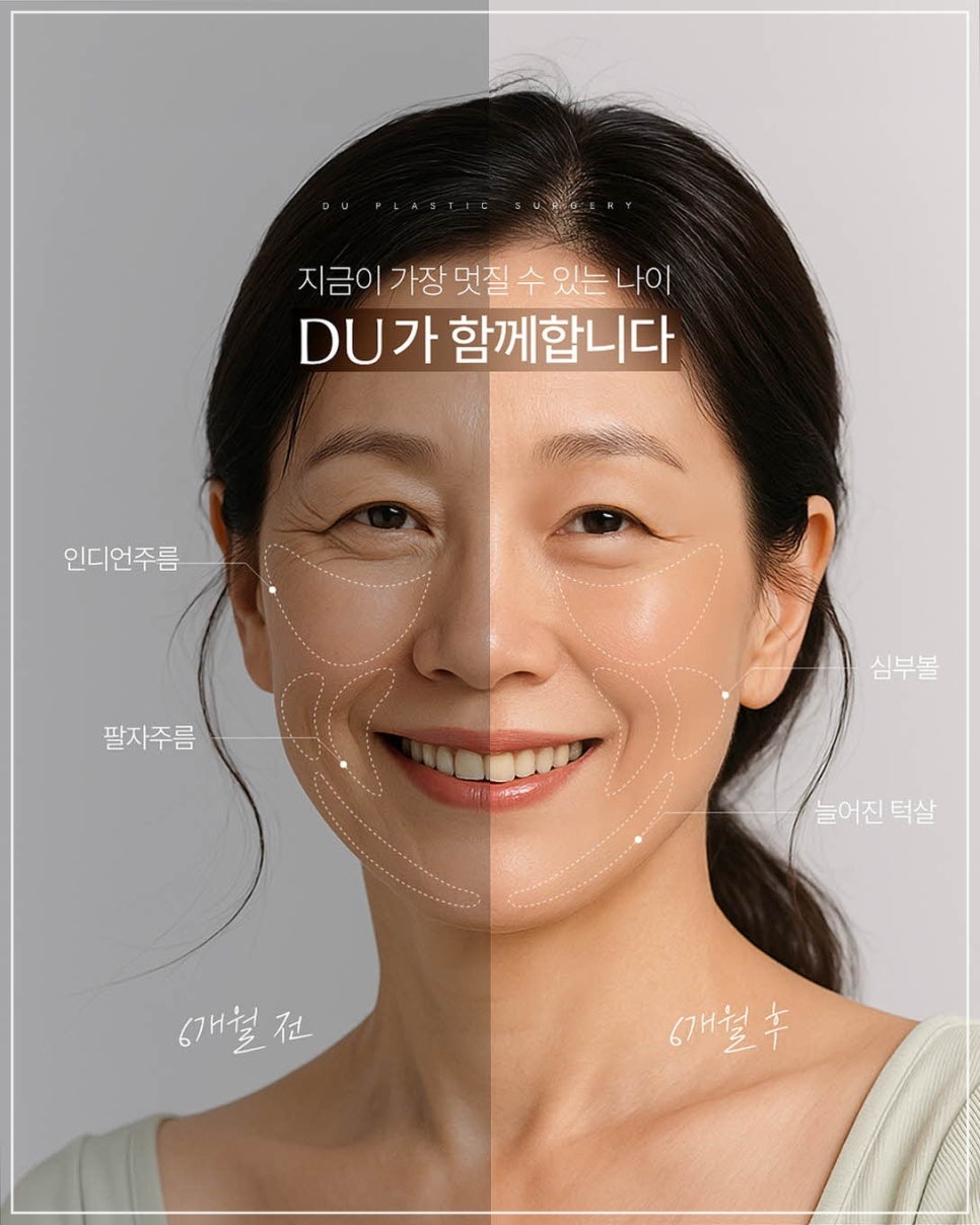 Why You Should Get a Mini Facelift in a Way That Suits You image 3