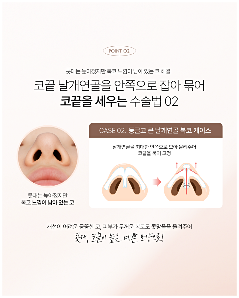 Male Nose Filler Side Effects: When Is Surgery Necessary? image 7
