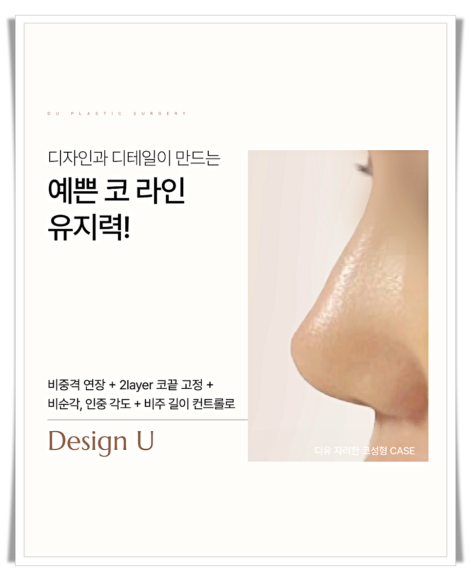 코끝처짐 원인과 교정 방법 관련 이미지 13