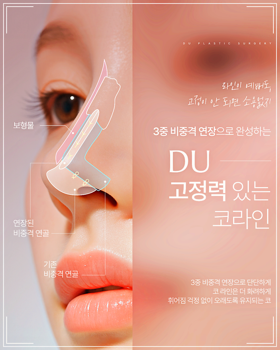 코끝필러퍼짐, 왜 생기고 어떻게 해결할까? 관련 이미지 12