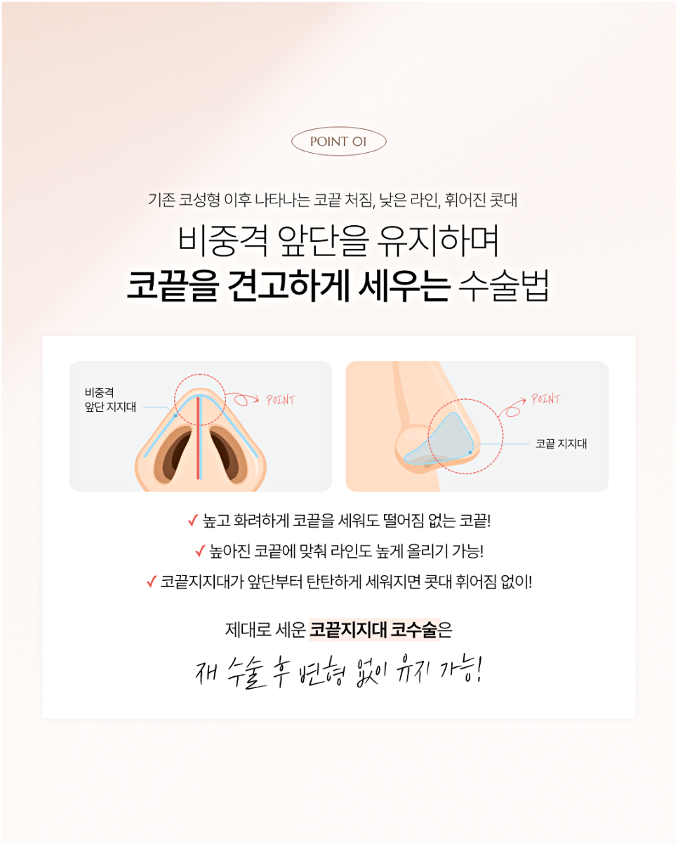 자가연골코성형 잘하는 곳 찾으시는 분들은 꼭 읽어보세요 관련 이미지 4
