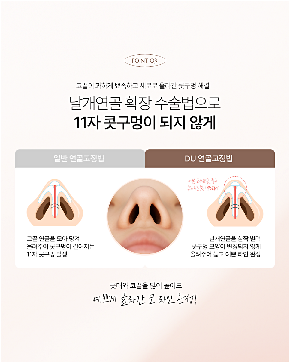 늑연골코수술부작용이 걱정되시는 분들은 읽어보세요 관련 이미지 7