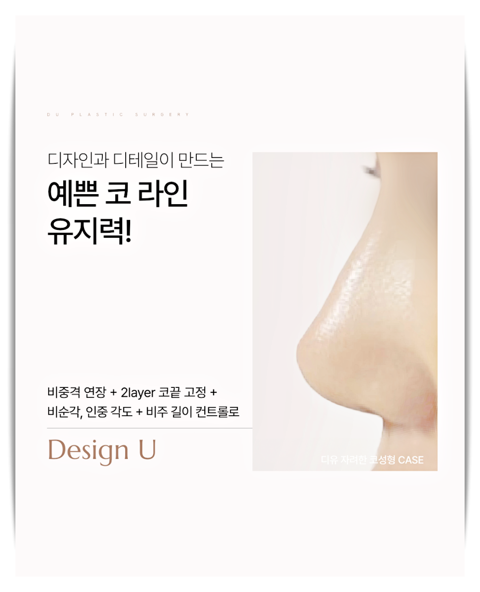 How to Prevent Nasal Tip Drooping image 11