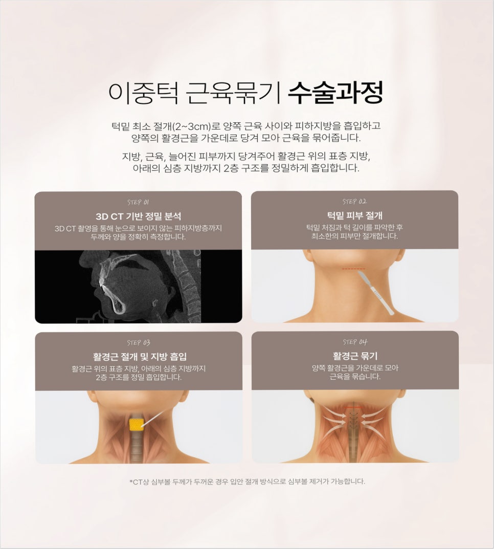 Why Double Chin Surgery Should Be Done at a Trusted Clinic image 3