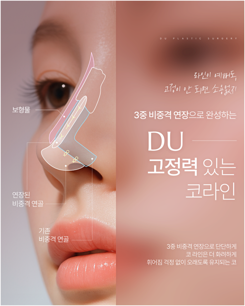 코재건 다시 또 수술하지 않으려면 꼭 알아야 할 한 가지 관련 이미지 10