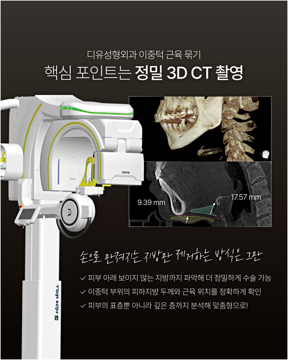 자가연골코성형 잘하는 곳 찾으시는 분들은 꼭 읽어보세요 관련 이미지 7